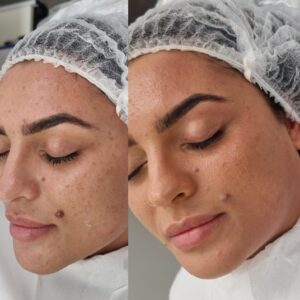 BB Glow Facial Course