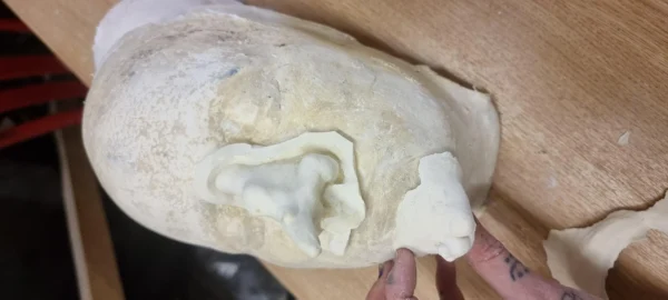 nose and chin prosthetics