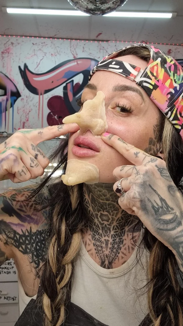 nose and chin prosthetics