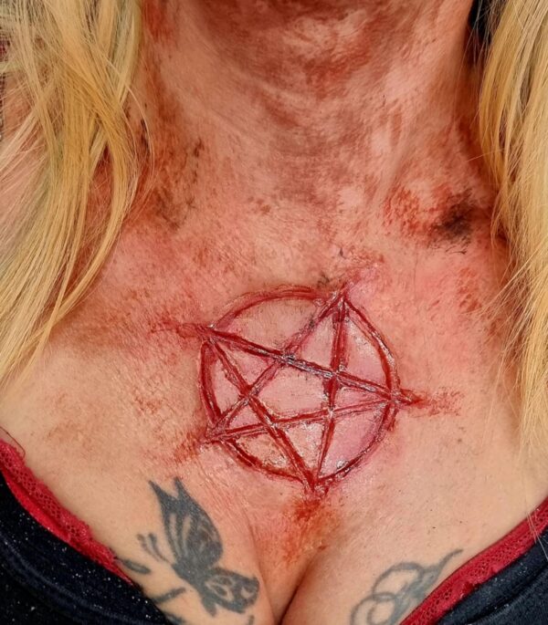 chest wounds prosthetics
