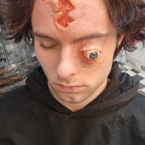 Eye and Head Wound