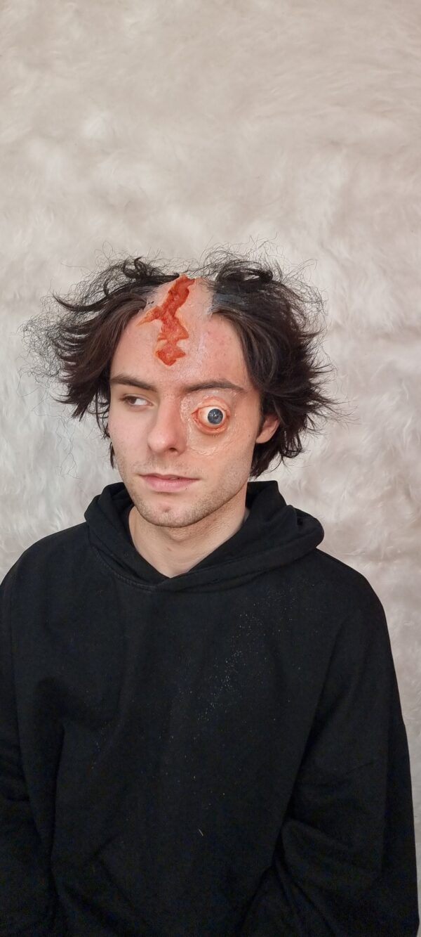 Eye and Head Wound - Image 10