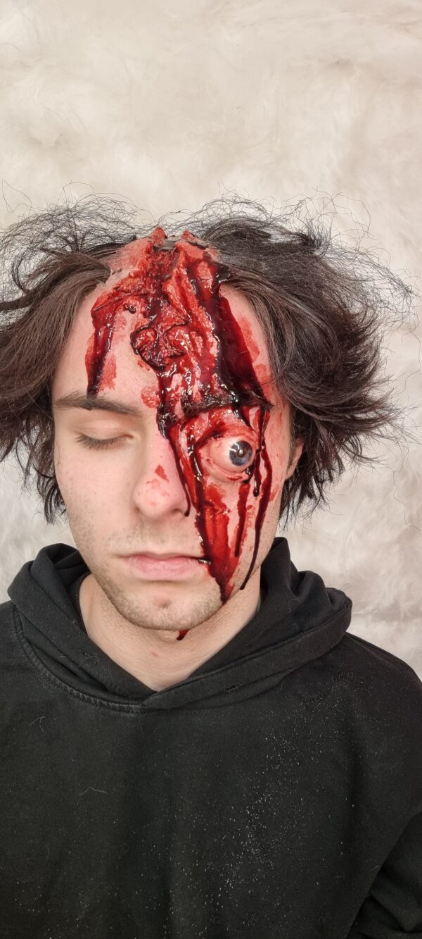 Eye and Head Wound - Image 12