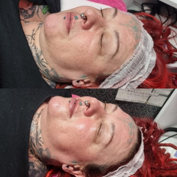 DIY facial lessons courses skin care lessons accredited