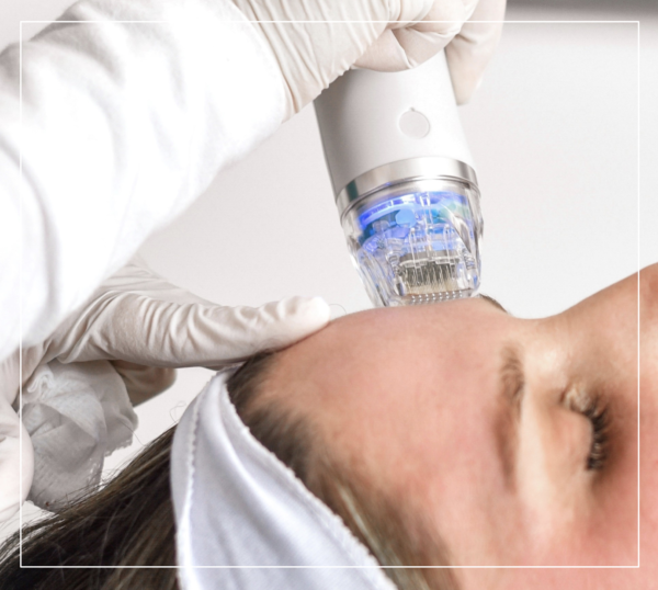 fractional radio frequency facial microneedling radio frequency